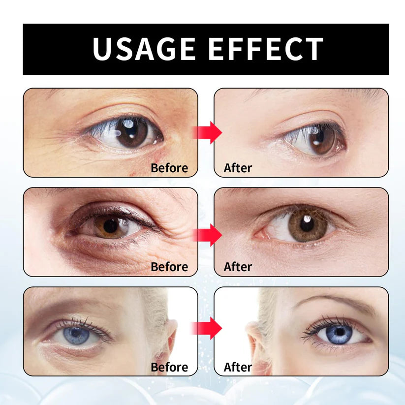 Instant Firm Eye Tightener - Instant Firm Eye Cream for Dark Circles - Celyn
