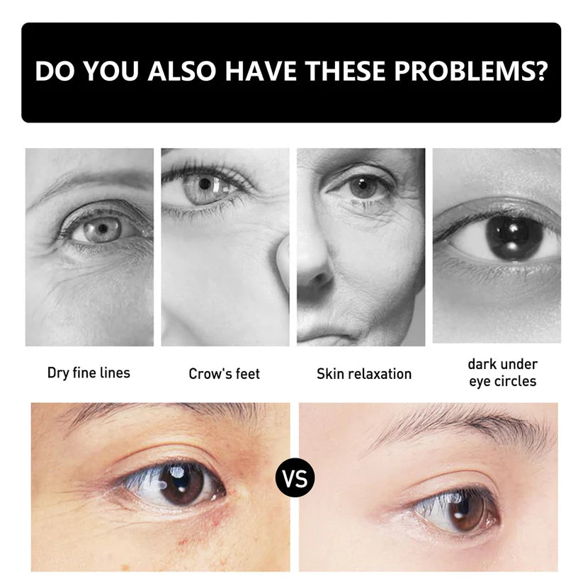 Instant Firm Eye Tightener - Instant Firm Eye Cream for Dark Circles - Celyn