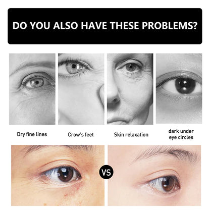 Instant Firm Eye Tightener - Instant Firm Eye Cream for Dark Circles - Celyn